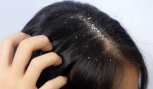 चायाँ परेर हैरान हुनुहन्छ? यि हुन् समाधानका उपाय