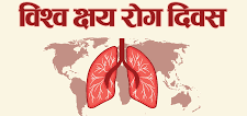 सक्रिय उमेर समूहमै क्षयरोगको संक्रमण धेरै